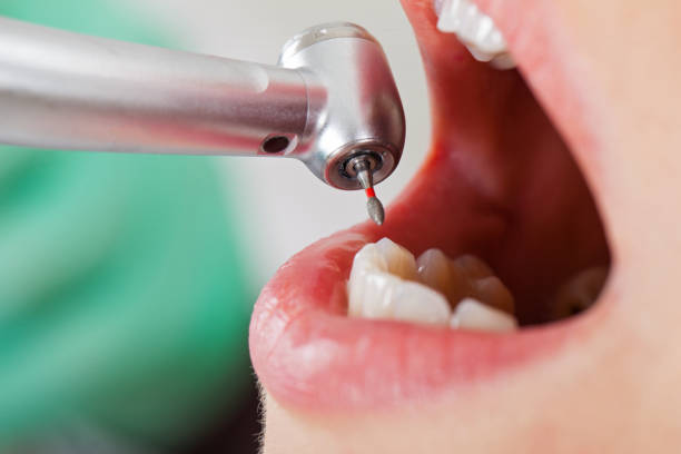 Professional Emergency Dental Service in MI
